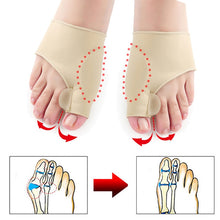 Load image into Gallery viewer, Bunion Correct Hammer Toe Splint Straightener Orthopedic Brace Hallux Valgus
